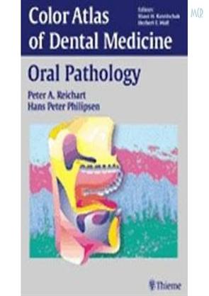 Color Atlas Of Dental Medicine - Oral Pathology 1St Edition, Dentistry ...