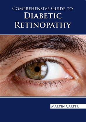 Comprehensive Guide To Diabetic Retinopathy (Hb 2023)