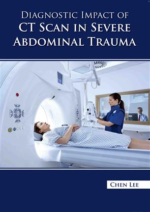 Diagnostic Impact Of Ct Scan In Severe Abdominal Trauma (Hb 2023)