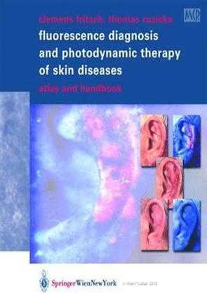 Fluorescence Diagnosis and Photodynamic Therapy of Skin Diseases Atlas ...