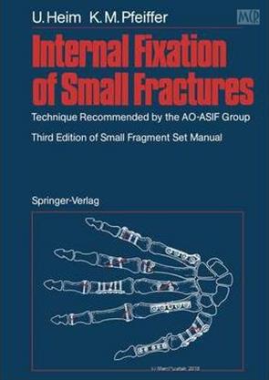 MANUAL OF INTERNAL FIXATION TECHNIQUE RECOMMENDED BY THE AO GROUP SWISS ASSOCIATION FOR THE STUDY OF INTERNAL FIXATION ASIF PDF intelligence overview