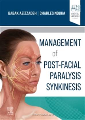 Management Of Post Facial Paralysis Synkinesis With Access Code (Hb ...