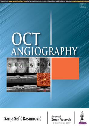 OCT Angiography 1st Edition 2018, 9789352703319, Sanja Sefic Kasumovic